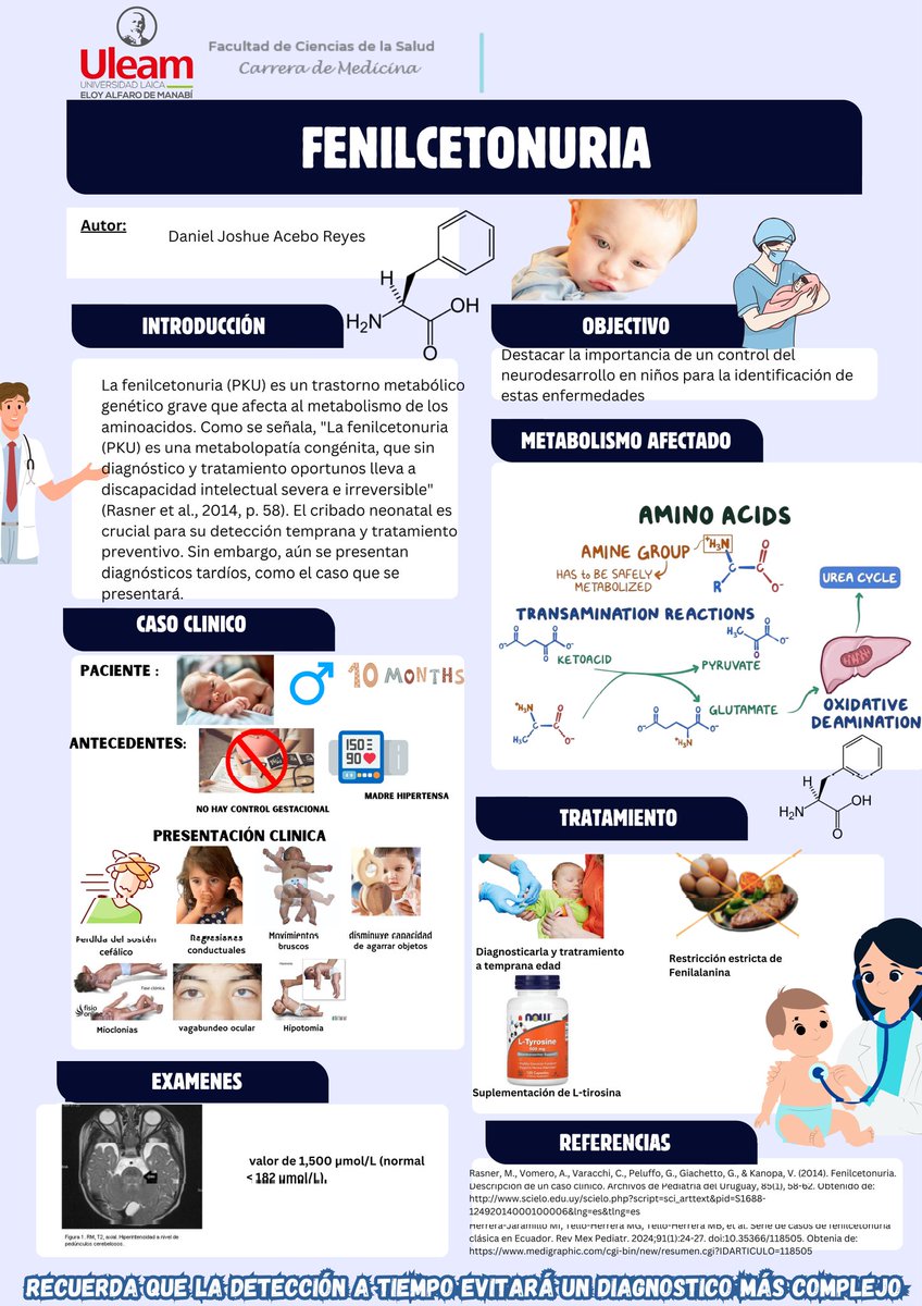 acebo_reyes's tweet photo. 👨‍⚕️⚠️¿Sabías que el metabolismo de la Tirosina es crucial? 🕔
❌️iCuando esta ruta bioquímica esencial falla se genera un trastorno metabólico hereditario que impacta el neurodesarrollo!🧠❎️ Conoce más: @Anghelo77ac @UleamEcuador #UleamEsAcademia #UleamEnBuenasManos #huntington https://t.co/lVy6NtH98g
