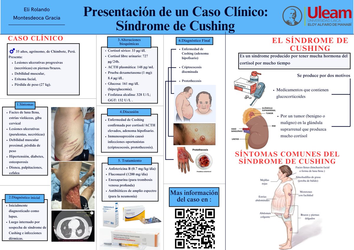 EliMontesd86184's tweet photo. Imagina despertar con un rostro más redondeado 😣, estrías rojizas en la piel 🔴 y una fatiga inexplicable 😴. El síndrome de Cushing, causado por un exceso de cortisol, afecta tanto la apariencia como el bienestar.
#UleamEcuador #UleamEnBuenasManos #UleamEsAcademia
@Anghelo77ac https://t.co/b7PDZmhQW3