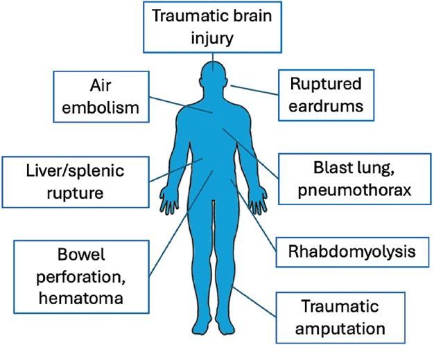 Elizabeth Malinzak, MD, FASA (@ebmalinzakmd) on Twitter photo Fascinating read about the anesthetic management of patients with injuries (both military and civilian) from IEDs in @asamonitor by Dr. Brent Lee and Dr. Joshua Junge. Thank you for your service Dr. Junge! @asalifeline <a href="/CorinnaYuMD/">Corinna Yu, MD, MBA, FASA</a>
buff.ly/hrYptDd Fascinating read about the anesthetic management of patients with injuries (both military and civilian) from IEDs in @asamonitor by Dr. Brent Lee and Dr. Joshua Junge. Thank you for your service Dr. Junge! @asalifeline <a href="/CorinnaYuMD/">Corinna Yu, MD, MBA, FASA</a>
buff.ly/hrYptDd
