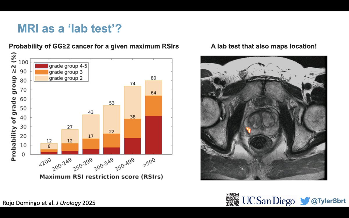 Tyler Seibert MD PhD (@tylersbrt) on Twitter photo Very high inter-reader variability is the achilles heel of #prostateMRI
What if #prostateMRI could be like a lab test that gives a quantitative value indicating risk of #ProstateCancer?
New 📜 <a href="/JUrology/">Journal of Urology</a>
🧵1/x
<a href="/AmerUrological/">Amer. Urol. Assn.</a> <a href="/Uroweb/">European Association of Urology (EAU)</a> <a href="/urotoday/">UroToday.com</a> <a href="/PCF_Science/">PCF Science</a> Very high inter-reader variability is the achilles heel of #prostateMRI
What if #prostateMRI could be like a lab test that gives a quantitative value indicating risk of #ProstateCancer?
New 📜 <a href="/JUrology/">Journal of Urology</a>
🧵1/x
<a href="/AmerUrological/">Amer. Urol. Assn.</a> <a href="/Uroweb/">European Association of Urology (EAU)</a> <a href="/urotoday/">UroToday.com</a> <a href="/PCF_Science/">PCF Science</a>
