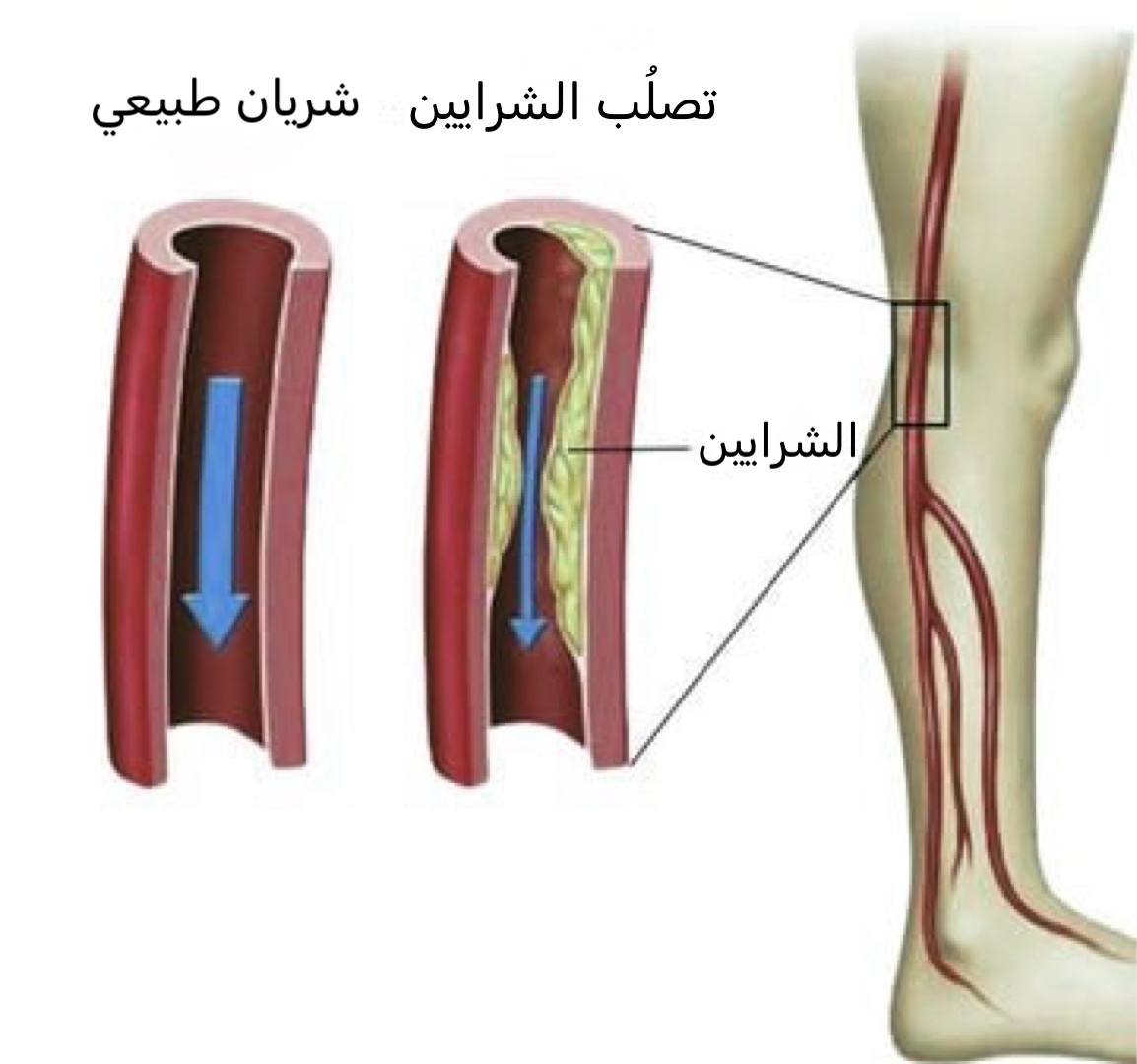إذا كنت تجلس أكثر من 6 ساعات في اليوم، ممكن يكون عندك ضعف في الدورة الدموية.

الموضوع ما يقتصر على "برودة اليدين" بس.

نقص تدفق الدم يعني إن مخك وأعضاء جسمك ما توصلهم الكمية الكافية من الأوكسجين،

وهذا ممكن يكون علامة مبكرة على أمراض قادمة.

سلسلة عن العلامات، والمخاطر، وحلول