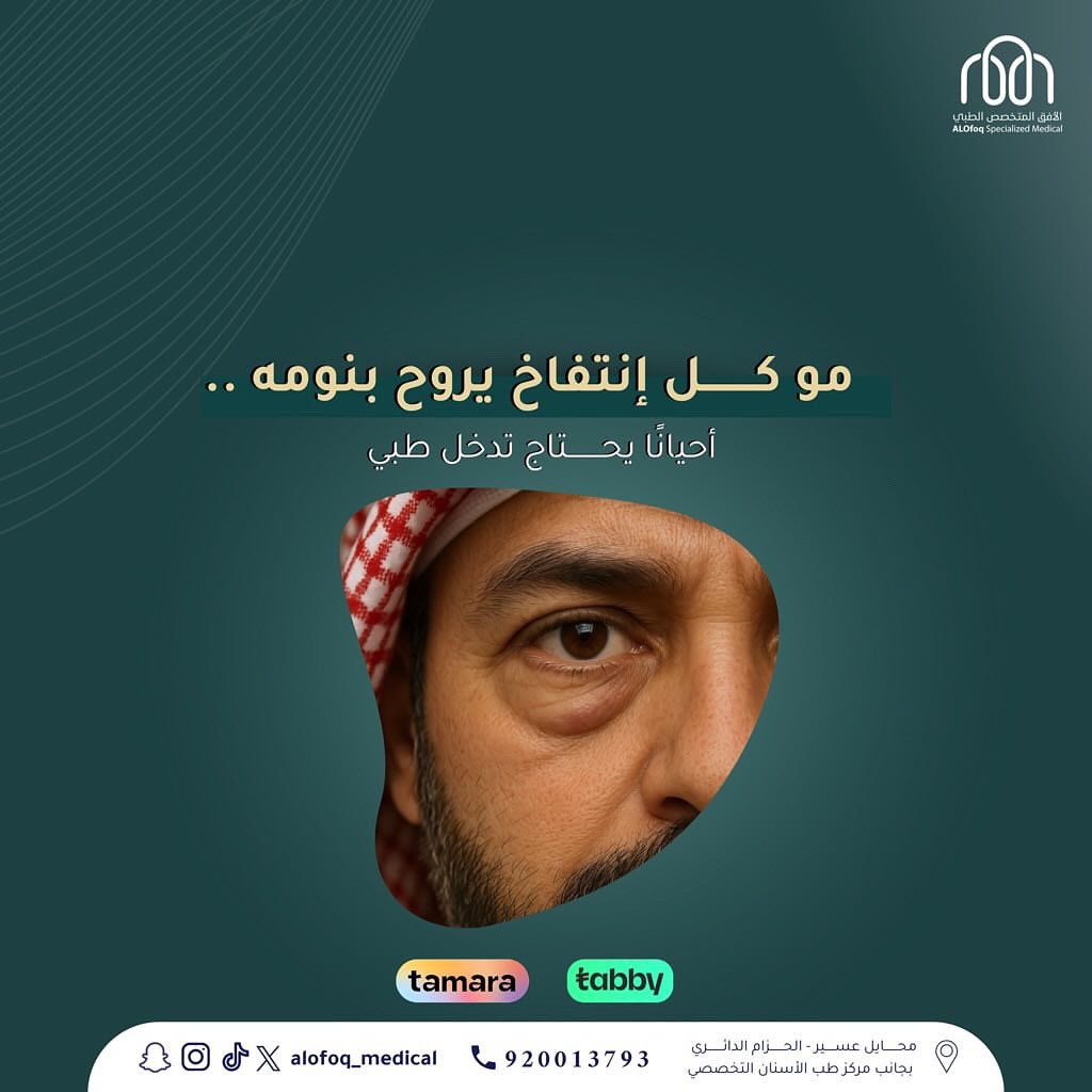 تجميل الجفون السفلية ، حل مثالي للتخلص من انتفاخات تحت العين 👨🏻‍⚕️👁️

خلي ملامحك ترتاح ✔️✨

#الجفون_السفلية #تجميل_العيون