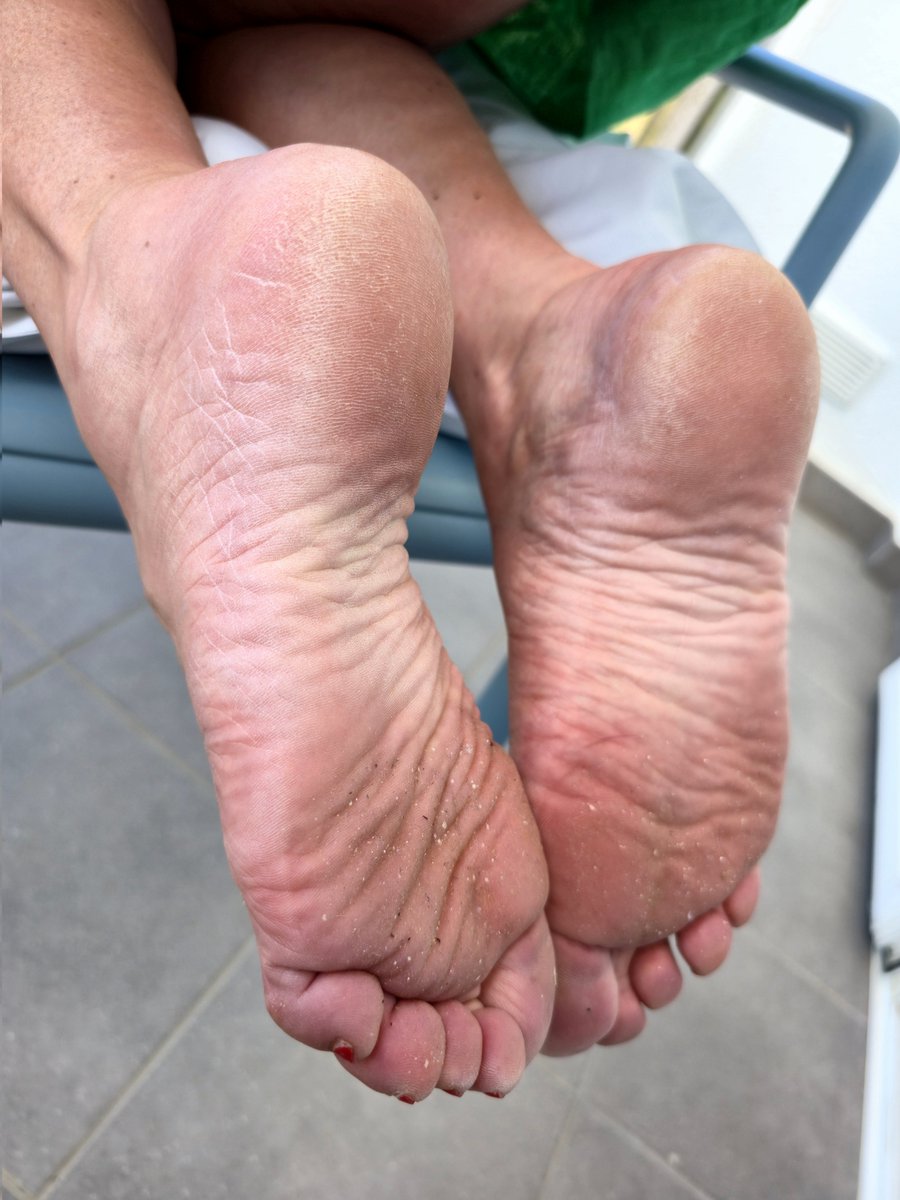 Dirty and rough #dirtyfeet #roughfeet #maturefeet #dryheels #feet #footfetish