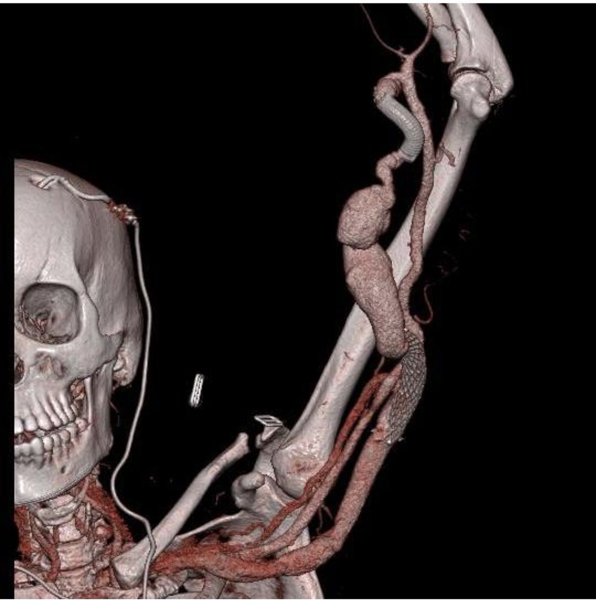 Oren Gottfried, MD tweet media