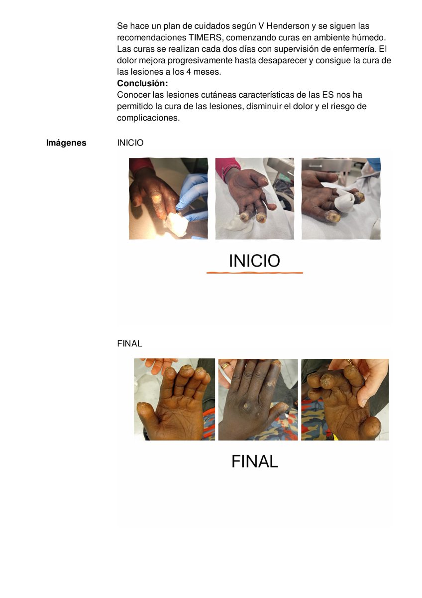 Silvia Garcia Diaz Rheumatology Nurse at CSI (@silviagarc80418) on Twitter photo Grupo Catalán de Reumatología #InfeReuCat presentamos algunos trabajos en el Congreso Nacional de Reumatología de la SER Madrid 2025 #SER2025, aquí comparto algunos de ellos <a href="/SlviaGarciaDia1/">Silvia Garcia Diaz Rheumatology Nurse CSI</a> <a href="/SCReuma/">Societat Catalana de Reumatologia</a> Grupo Catalán de Reumatología #InfeReuCat presentamos algunos trabajos en el Congreso Nacional de Reumatología de la SER Madrid 2025 #SER2025, aquí comparto algunos de ellos <a href="/SlviaGarciaDia1/">Silvia Garcia Diaz Rheumatology Nurse CSI</a> <a href="/SCReuma/">Societat Catalana de Reumatologia</a>