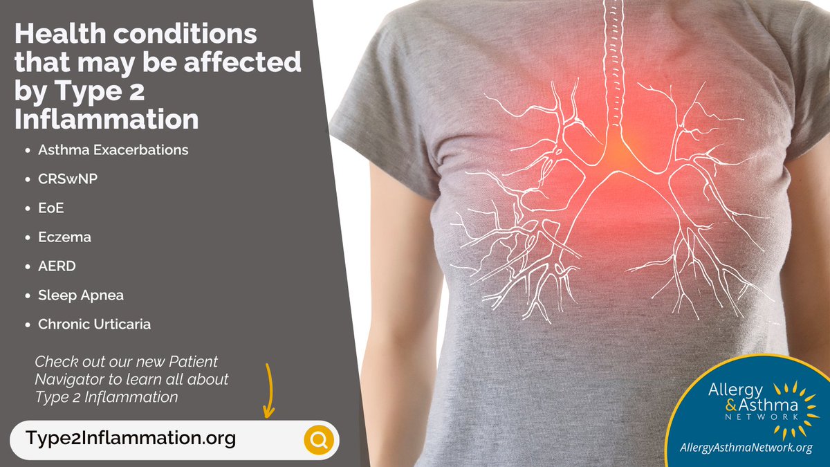 APFED.org (@apfedorg) on Twitter photo #Type2inflammation is linked to #asthma, #eczema, #EoE, #hives & more. It can seriously impact daily life. Talk to your doctor about treatments like biologics. Learn more: Type2Inflammation.org
Thanks to <a href="/AllergyAsthmaHQ/">Allergy & Asthma Network</a> for supporting this campaign. #Type2inflammation is linked to #asthma, #eczema, #EoE, #hives & more. It can seriously impact daily life. Talk to your doctor about treatments like biologics. Learn more: Type2Inflammation.org
Thanks to <a href="/AllergyAsthmaHQ/">Allergy & Asthma Network</a> for supporting this campaign.
