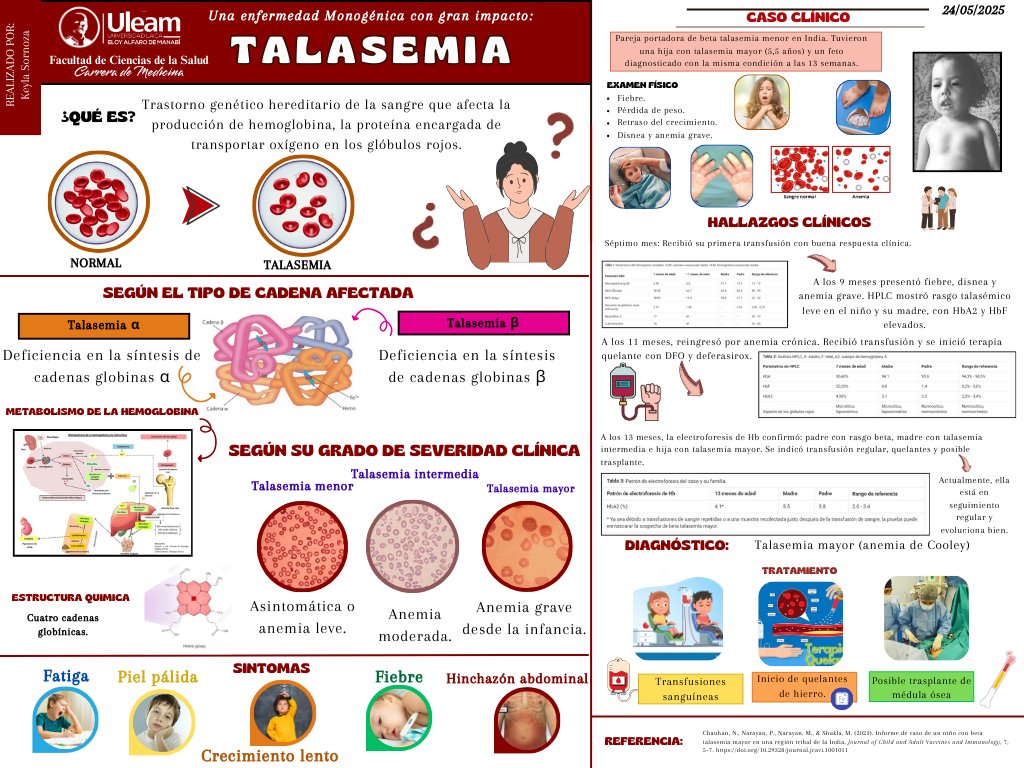 keyla_sornoza's tweet photo. La talasemia es una enfermedad genética que afecta la producción de hemoglobina en la sangre. ¡Conoce más sobre esta condición y su tratamiento!
@UleamEcuador @Anghelo77ac 
#UleamEnBuenasManos
#UleamEsAcademia https://t.co/UfhOcZAC6x