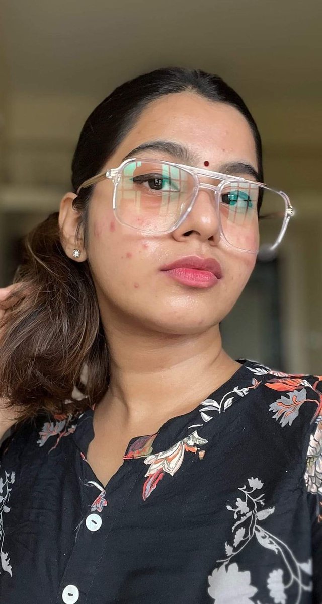 पिम्पल का कोई इलाज हो तो कोई बताये....?😳