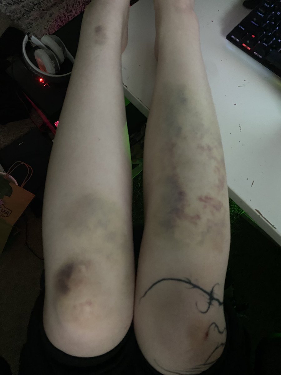 I fell :( what the helly