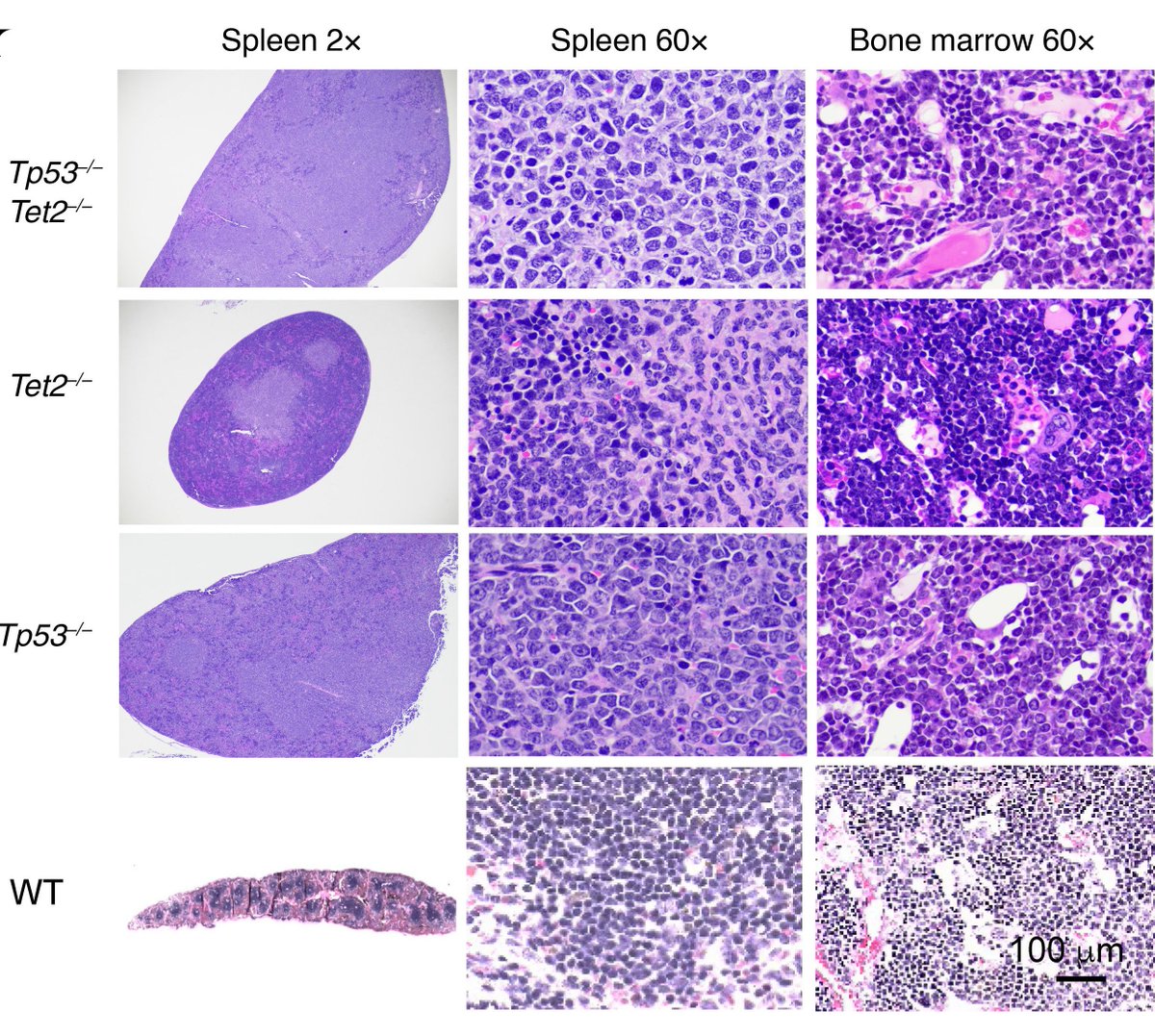 ASCI (@the_asci) on Twitter photo An exemplary connection between human and mouse data in AML!
ASCI member <a href="/AbdelWahablab/">Abdel-Wahab Lab</a> & team studied genetic alterations in a large cohort of patients with TP53-mutant AML and identified TET2. Check out the mouse model and a new therapeutic approach: jci.org/articles/view/… An exemplary connection between human and mouse data in AML!
ASCI member <a href="/AbdelWahablab/">Abdel-Wahab Lab</a> & team studied genetic alterations in a large cohort of patients with TP53-mutant AML and identified TET2. Check out the mouse model and a new therapeutic approach: jci.org/articles/view/…