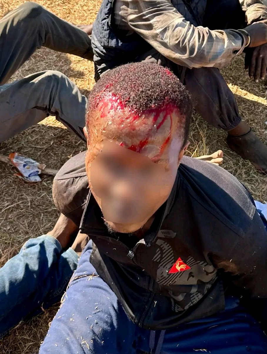 In Blackburn, KZN, a mob of angry community members captured six men on Monday, accusing two of them of criminal activity in the area. 

The other four were reportedly innocent but were beaten for information. 

All six were tied up, assaulted, and threatened with being set on