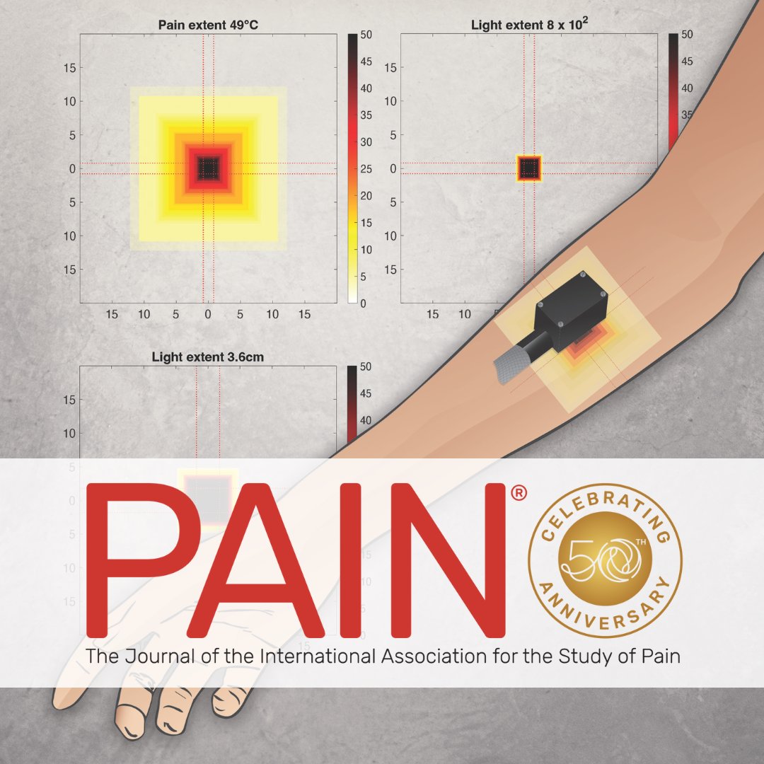 PAIN Journal (@painthejournal) on Twitter photo The June cover of #PAIN represents the device used in <a href="/Waclaw_Adamczyk/">Vatsi M. Adamczyk</a> et al.’s study of pain radiation. Learn more bit.ly/3S0LTuS The June cover of #PAIN represents the device used in <a href="/Waclaw_Adamczyk/">Vatsi M. Adamczyk</a> et al.’s study of pain radiation. Learn more bit.ly/3S0LTuS