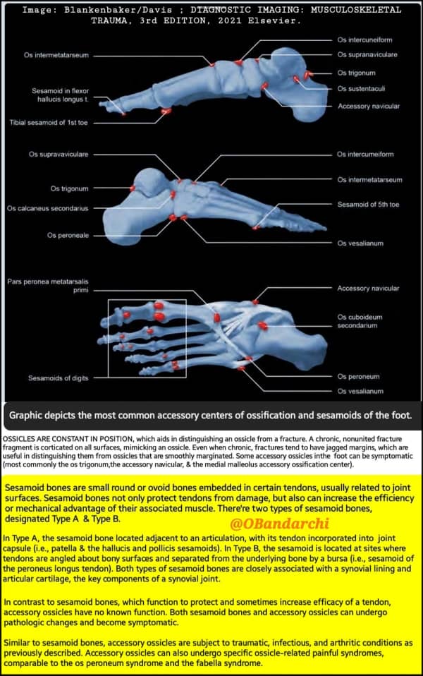🛑In contrast to SESAMOID BONES (has 2 types: A &amp; B), which function to protect &amp; sometimes increase efficacy of a tendon, ACCESSORY OSSICLES are have no known function, but are constant in position.

Both can undergo pathologic changes &amp; become symptomatic.