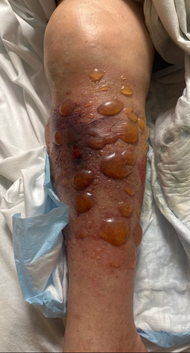 Who is the genius who thought that this was ok and what was their rationale for accepting this?