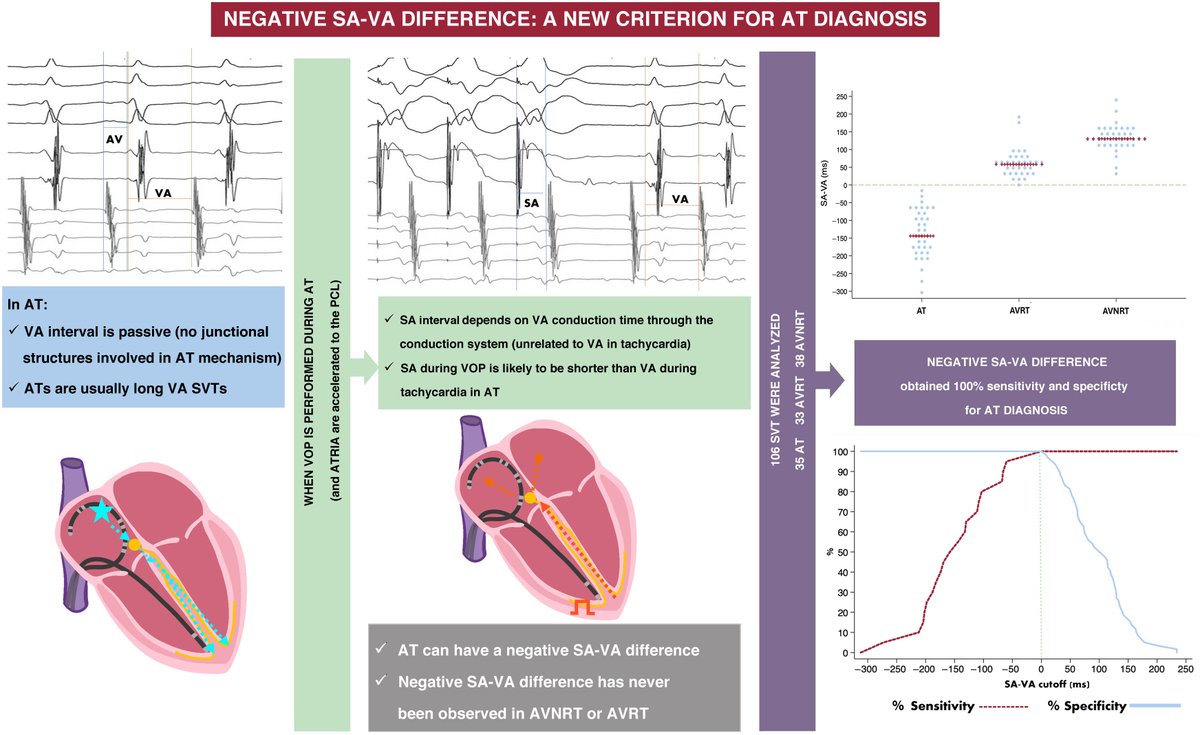 REC Publications (@revespcardiol) on Twitter photo Negative SA-VA difference during ventricular overdrive pacing of supraventricular tachycardia for the diagnosis of atrial tachycardia #REC #Aheadofprint <a href="/Raquel_Adelino/">Raquel Adeliño</a> <a href="/VictorBazanG/">Victor Bazan</a> <a href="/bisbal_EP/">Felipe Bisbal</a> <a href="/Pablus_199/">Pablo Jordán</a> <a href="/carloseduardogm/">Carlos González</a> <a href="/rogervilluendas/">Roger Villuendas</a> <a href="/NuriaRivasGndar/">Nuria Rivas Gándara</a> revespcardiol.org/en-negative-sa… Negative SA-VA difference during ventricular overdrive pacing of supraventricular tachycardia for the diagnosis of atrial tachycardia #REC #Aheadofprint <a href="/Raquel_Adelino/">Raquel Adeliño</a> <a href="/VictorBazanG/">Victor Bazan</a> <a href="/bisbal_EP/">Felipe Bisbal</a> <a href="/Pablus_199/">Pablo Jordán</a> <a href="/carloseduardogm/">Carlos González</a> <a href="/rogervilluendas/">Roger Villuendas</a> <a href="/NuriaRivasGndar/">Nuria Rivas Gándara</a> revespcardiol.org/en-negative-sa…