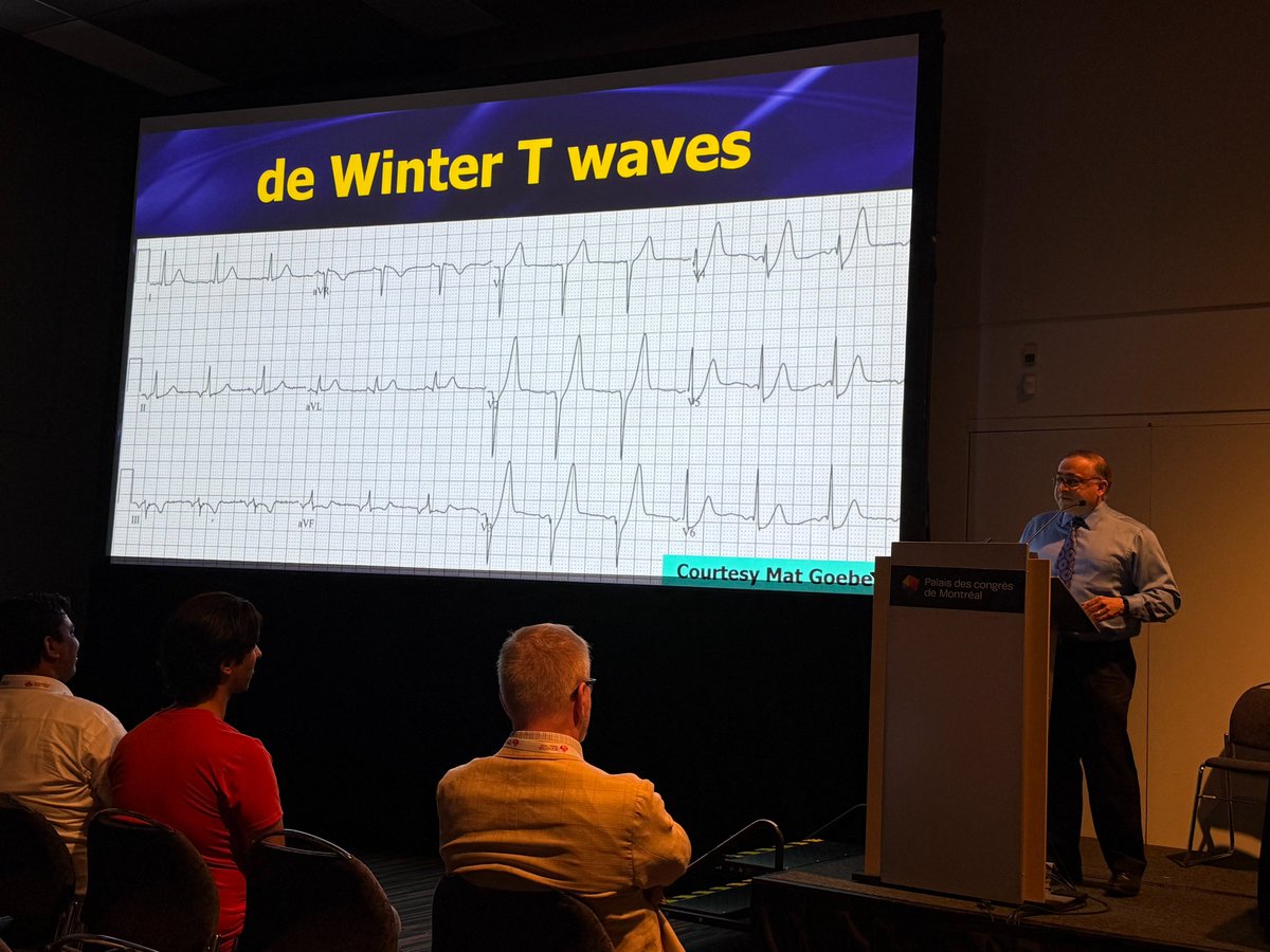 International Conference on Emergency Medicine (@icem2025) on Twitter photo 🧵What’s the Latest in Emergency Electrocardiography?
By Dr. Amal Mattu <a href="/amalmattu/">Amal Mattu</a> | #ICEM2025
Missed ECG findings = missed occlusions. Here are two patterns you must know ⬇️
#ECG #FOAMed #EmergencyMedicine 🧵What’s the Latest in Emergency Electrocardiography?
By Dr. Amal Mattu <a href="/amalmattu/">Amal Mattu</a> | #ICEM2025
Missed ECG findings = missed occlusions. Here are two patterns you must know ⬇️
#ECG #FOAMed #EmergencyMedicine