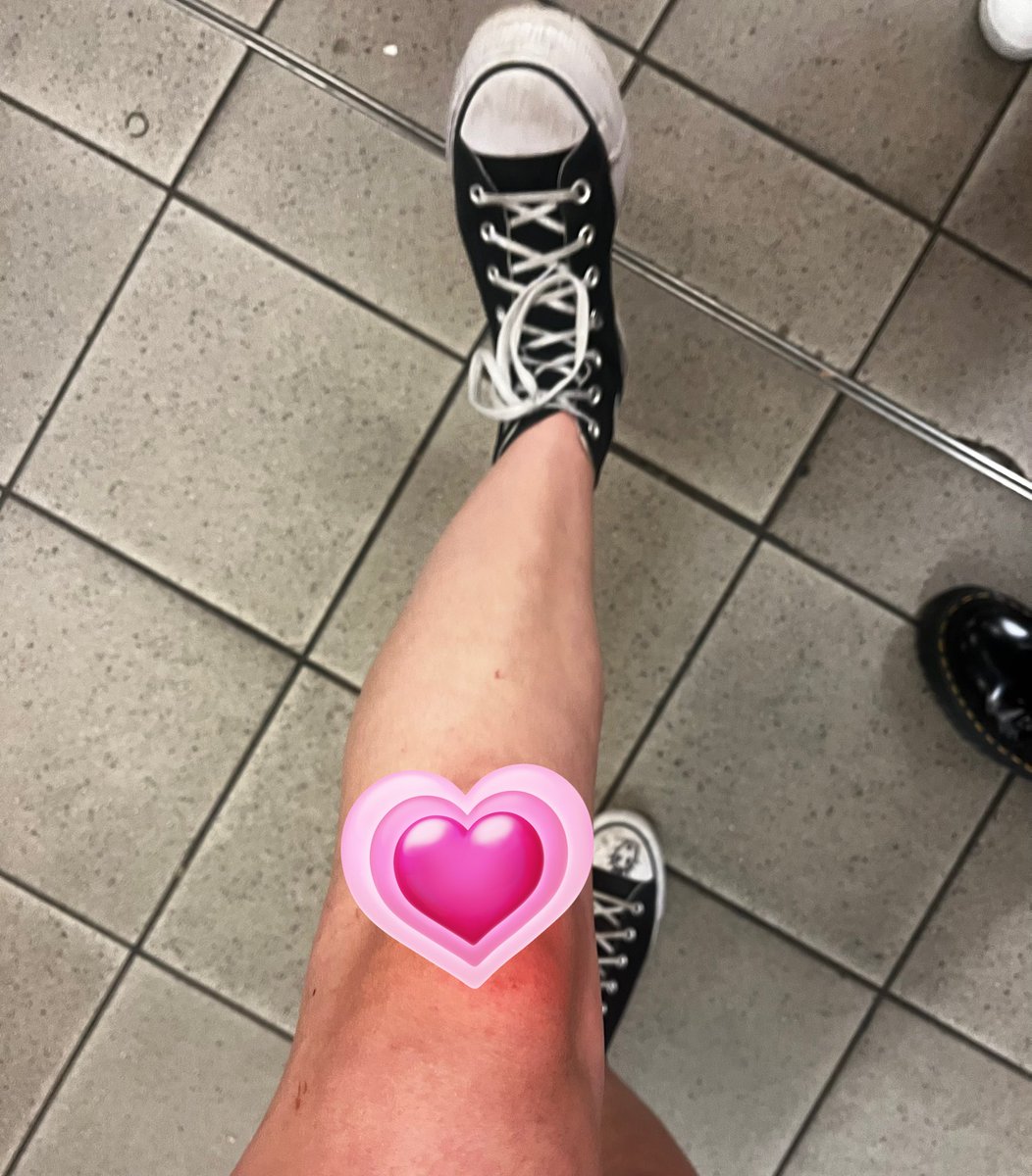 blurryave's tweet image. my converse after bowery vs after london night 2, these shoes have gone through the unspeakable