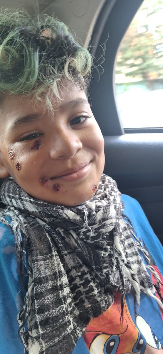 "Volviendo a Casa🤴🏻💪🏻🙌🏻❤️". Esta imagen me la manda la mamá de Julio.
 Julito estaba estudiando en su cuarto en el barrio IAPI de Quilmes. Cuando se asomó por la ventana alertado por gritos, un bonaerense del comando especial UTOI lo baleó en la cara. Julito protegió a su hermana