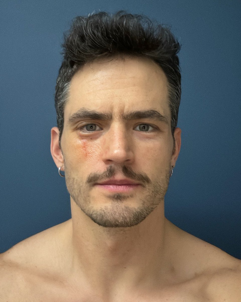 Recuerdo del madrazo que me metí.