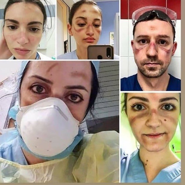 Se acuerdan cuando Alberto Fernández dijo que los médicos se RELAJARON y por eso mvrió más gente? 

No los ví quejarse a algunos. Memoria.