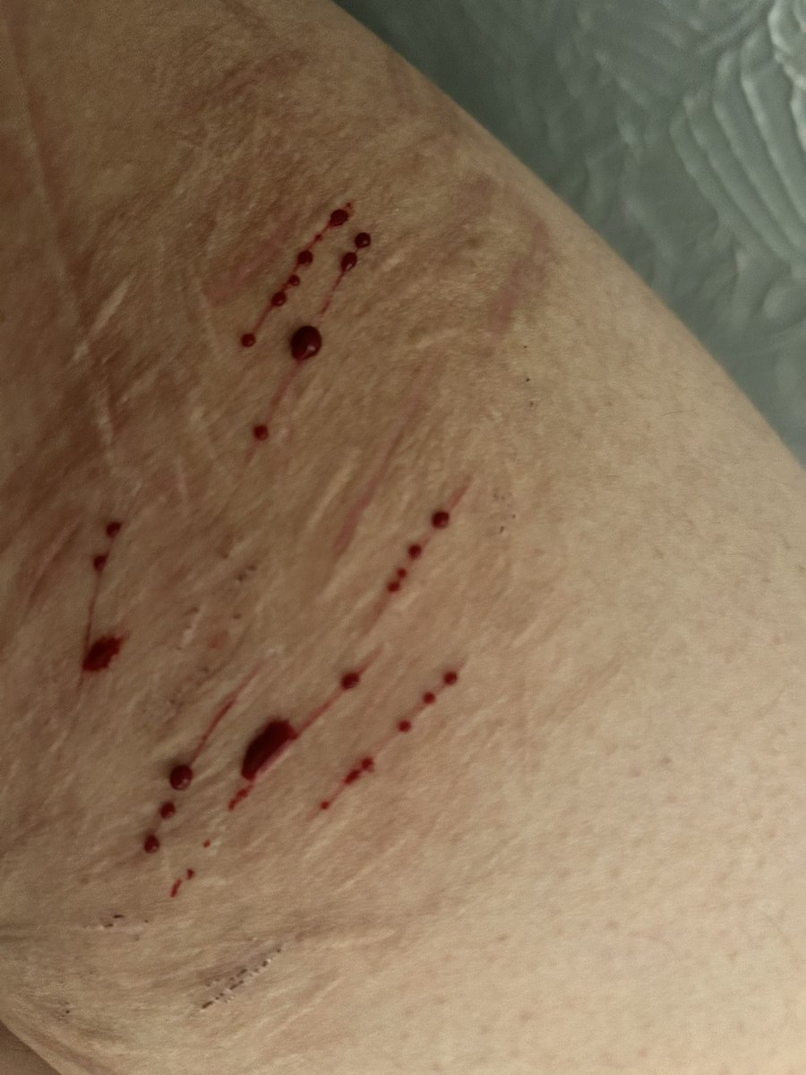 4sp3nluvz's tweet photo. Small sesh !! (I need new sh4rpenerz) https://t.co/nbL6USAqK7