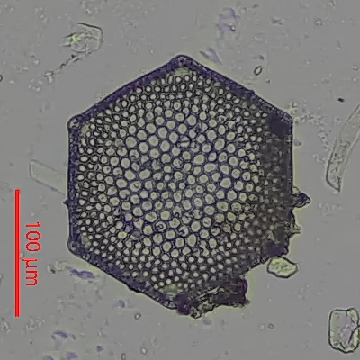 microscope61's tweet photo. 放散虫の日関連のイベントでいただいた千葉県天津層のサンプル中の珪藻化石その２。Triceratiumの仲間たち。1枚目はT.favus、2枚目はT. pantocsekii、3枚目はT.formosu f.formosum、4枚目はT. cf. circumvallatumかな？種名に関しては私は素人なので間違っている可能性が大です。#放散虫 #天津層 #珪藻 https://t.co/MqnwEwGr9q