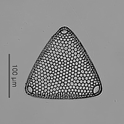 microscope61's tweet photo. 放散虫の日関連のイベントでいただいた千葉県天津層のサンプル中の珪藻化石その２。Triceratiumの仲間たち。1枚目はT.favus、2枚目はT. pantocsekii、3枚目はT.formosu f.formosum、4枚目はT. cf. circumvallatumかな？種名に関しては私は素人なので間違っている可能性が大です。#放散虫 #天津層 #珪藻 https://t.co/MqnwEwGr9q