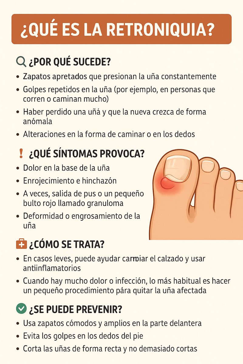 ¿Qué es la retroniquia?