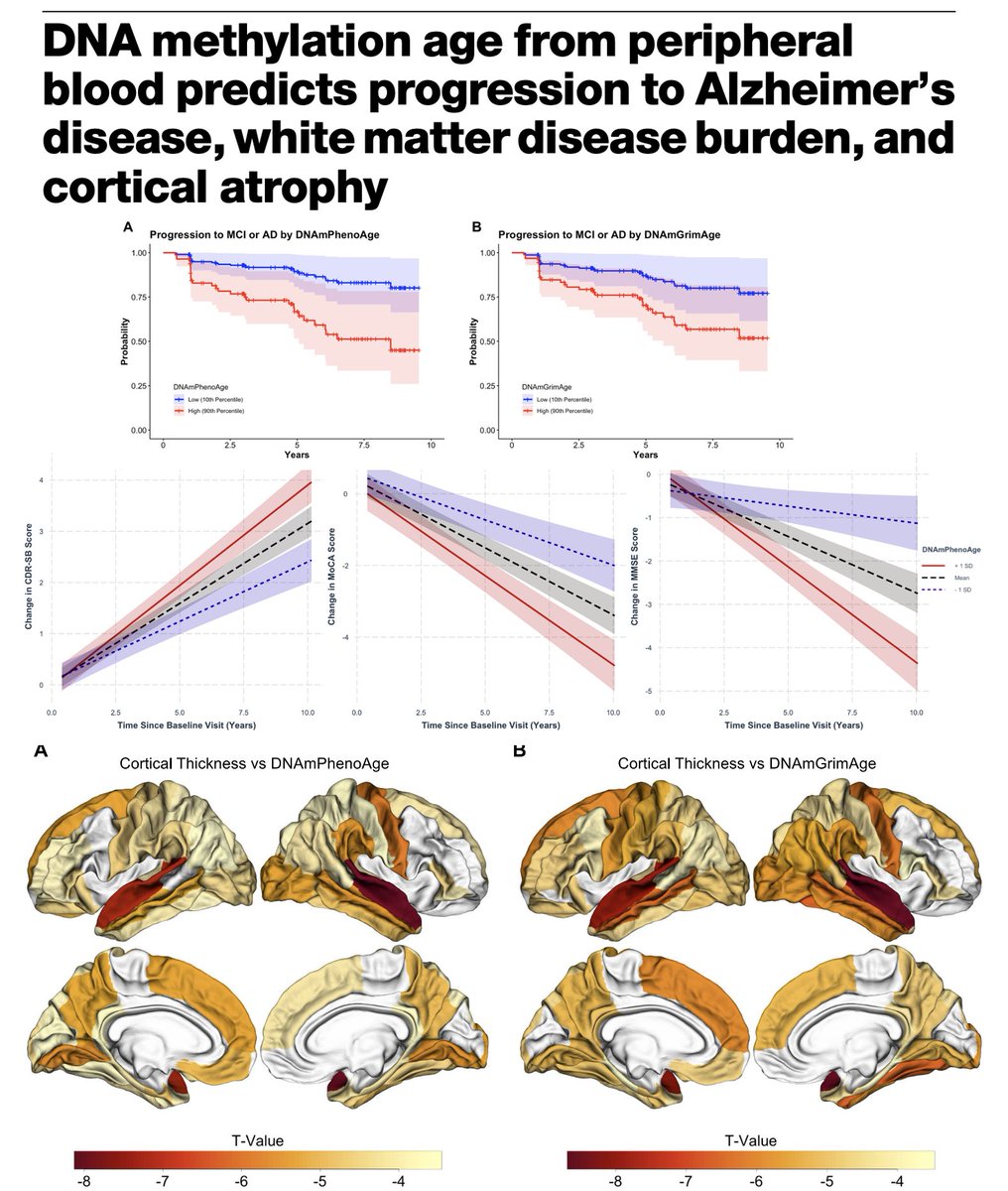 Agustin Ibañez (@agustinmibanez) on Twitter photo Using longitudinal modeling + neuroimaging, we show that 2nd-generation epigenetic clocks (DNAmPhenoAge + DNAmGrimAge) predict Alzheimer’s progression and are associated with cortical thinning and WMH. nature.com/articles/s4440… Congrats L. Bonham & <a href="/michaeljcorley/">Michael Corley</a>! <a href="/nanosanta/">Hernando SantamarĂa-GarcĂa</a> Using longitudinal modeling + neuroimaging, we show that 2nd-generation epigenetic clocks (DNAmPhenoAge + DNAmGrimAge) predict Alzheimer’s progression and are associated with cortical thinning and WMH. nature.com/articles/s4440… Congrats L. Bonham & <a href="/michaeljcorley/">Michael Corley</a>! <a href="/nanosanta/">Hernando SantamarĂa-GarcĂa</a>