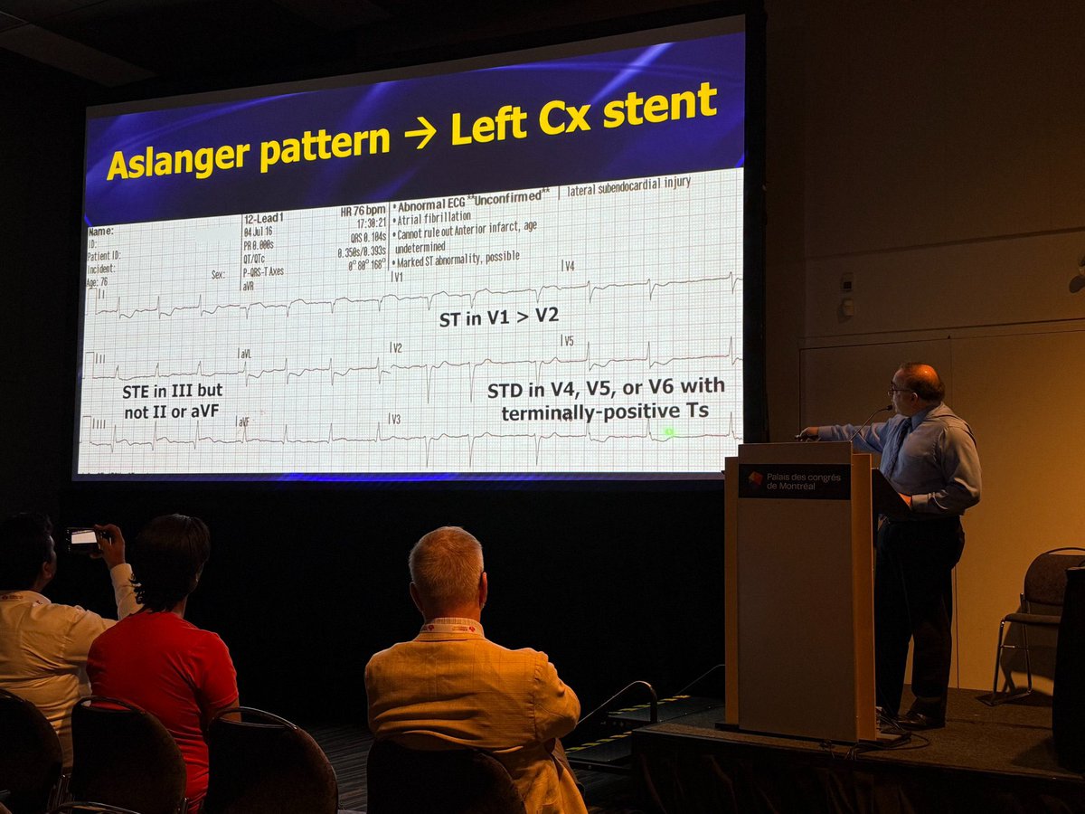 Qasem Ahmed (@qalmulihi) on Twitter photo What’s the Latest in ECG?
Dr. Amal Mattu <a href="/amalmattu/">Amal Mattu</a> <a href="/ICEM2025/">International Conference on Emergency Medicine</a>
❌De Winter = LAD occlusion with ST depression & tall T in V2–V4.
❌ Aslanger = Inferior MI: ST ↑ only in III + ST ↓ in V2 (not V1).
Both are STEMI equivalents — recognize & activate! What’s the Latest in ECG?
Dr. Amal Mattu <a href="/amalmattu/">Amal Mattu</a> <a href="/ICEM2025/">International Conference on Emergency Medicine</a>
❌De Winter = LAD occlusion with ST depression & tall T in V2–V4.
❌ Aslanger = Inferior MI: ST ↑ only in III + ST ↓ in V2 (not V1).
Both are STEMI equivalents — recognize & activate!