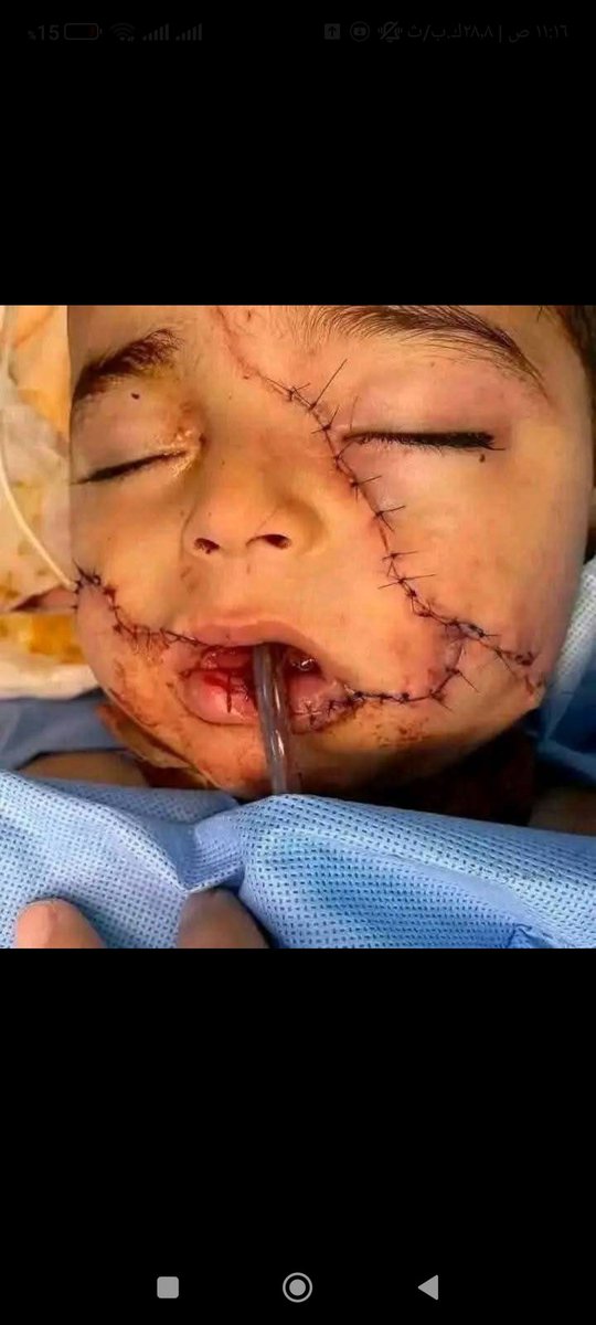 هنا غزة ✌🏻🥹💔
#غزة_تُباد