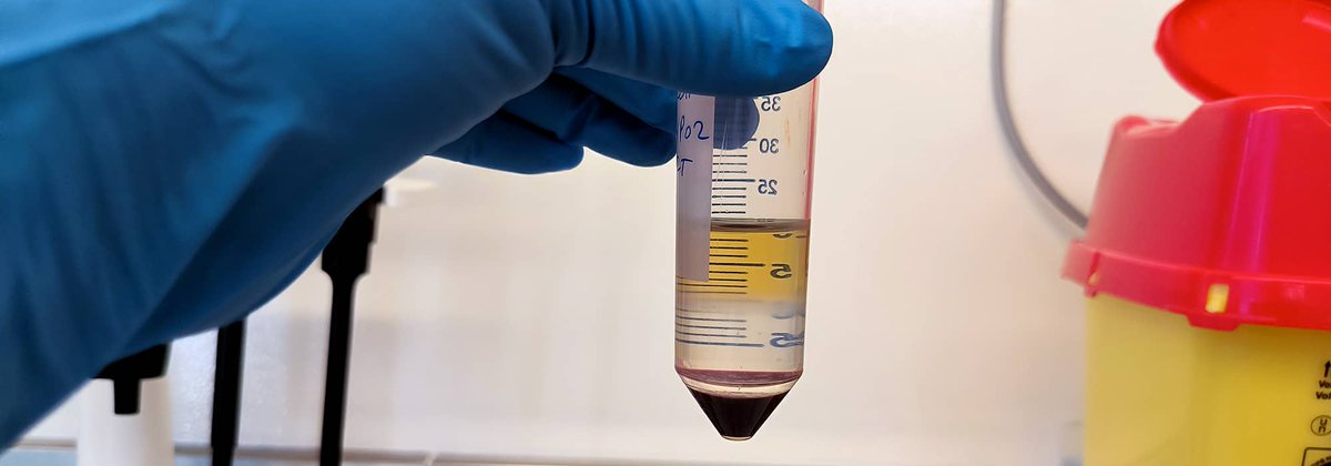 GIS IBiSA (@gis_ibisa) on Twitter photo Le CRB du <a href="/CHUNimes/">CHU de Nîmes</a> conserve et distribue des collections d’échantillons biologiques humains pour la recherche ➡️ ibisa.net/annuaire-crb/c…. Le CRB du <a href="/CHUNimes/">CHU de Nîmes</a> conserve et distribue des collections d’échantillons biologiques humains pour la recherche ➡️ ibisa.net/annuaire-crb/c….