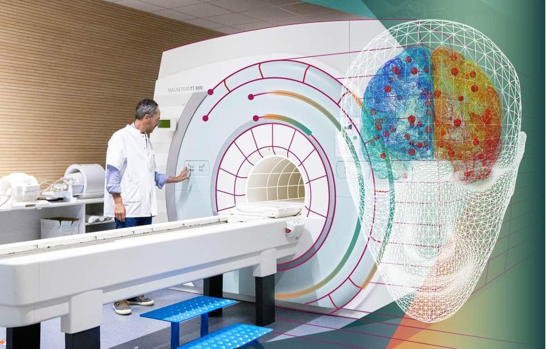 A new computer model of Parkinson's disease has been created by researchers in France and Italy and tested in a first small-scale patient trial. 

The modelling is powered by <a href="/thevirtualbrain/">The Virtual Brain</a>, a platform for constructing and simulating personalised brain network models, which is