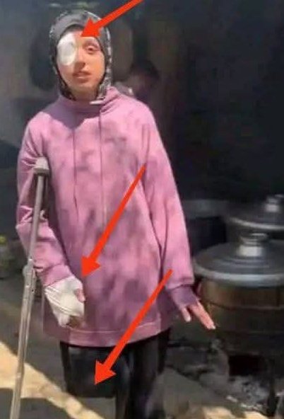 إنها تطبخ للجياع.💔😭