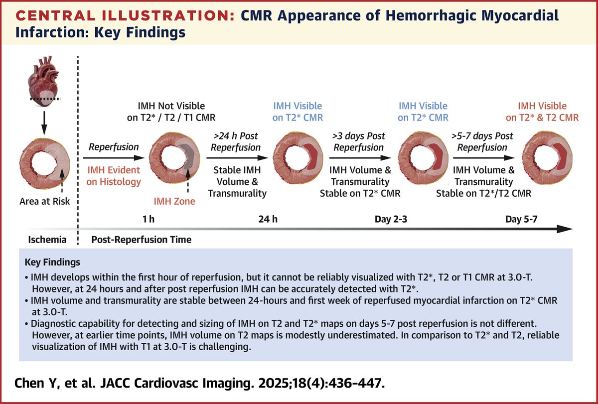 OklahomaACC (@acc_oklahoma) on Twitter photo Hemorrhagic MI can’t be reliably detected using T1, T2, or T2* at 3.0-T #whyCMR immediately post-reperfusion—but T2* and T2 maps at 3.0-T can diagnose hemorrhagic MI in the days that follow.
đź”— ow.ly/XLsZ50VArfa
#JACCIMG #cvImaging #cvMI <a href="/rohandkumar1/">Rohan Dharmakumar</a> <a href="/KeyurVoraMD/">Keyur P. Vora</a> Hemorrhagic MI can’t be reliably detected using T1, T2, or T2* at 3.0-T #whyCMR immediately post-reperfusion—but T2* and T2 maps at 3.0-T can diagnose hemorrhagic MI in the days that follow.
đź”— ow.ly/XLsZ50VArfa
#JACCIMG #cvImaging #cvMI <a href="/rohandkumar1/">Rohan Dharmakumar</a> <a href="/KeyurVoraMD/">Keyur P. Vora</a>
