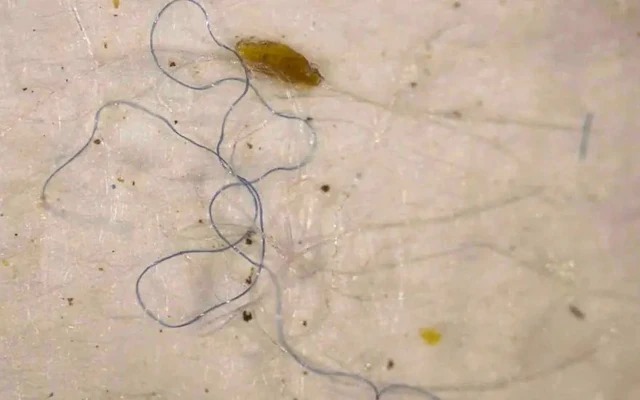 MarioNawfal's tweet photo. MICROPLASTICS JUST CRAWLED INTO YOUR SALAD...

Scientists just found microplastics inside earthworms, beetles, slugs, and snails. 

Which means your backyard food chain is now basically polyester-flavored.

Some bugs had plastic fibers a quarter the length of their body. 

One beetle was rocking a nylon thread like a digestive runway model.

Source? Likely clothing fibers flushed out in sewage sludge and used as farm fertilizer. 

Yes, your yoga pants might be feeding garden worms.

This marks the 1st time microplastics have been found across entire land-based ecosystems: from dirt-eating worms to the birds and mammals that eat them.

Congrats to all of us: the plastic crisis just went even more micro...

Source: The Telegraph