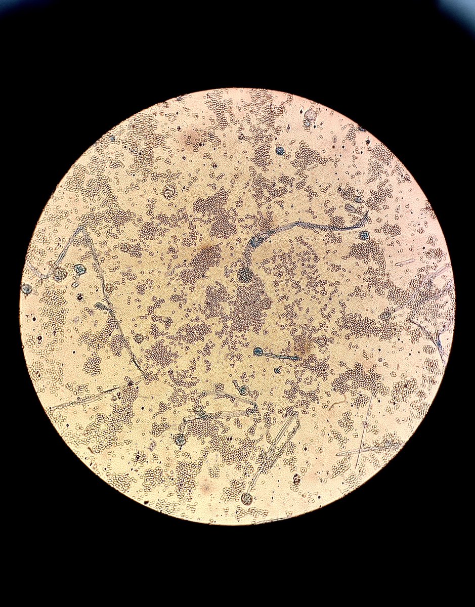 Tenemos “Mucor” en las instalaciones (¿defecto o virtud?) y un intenso debate en la evaluaciones del primer año de DUAL.

¿Vosotros qué tenéis?