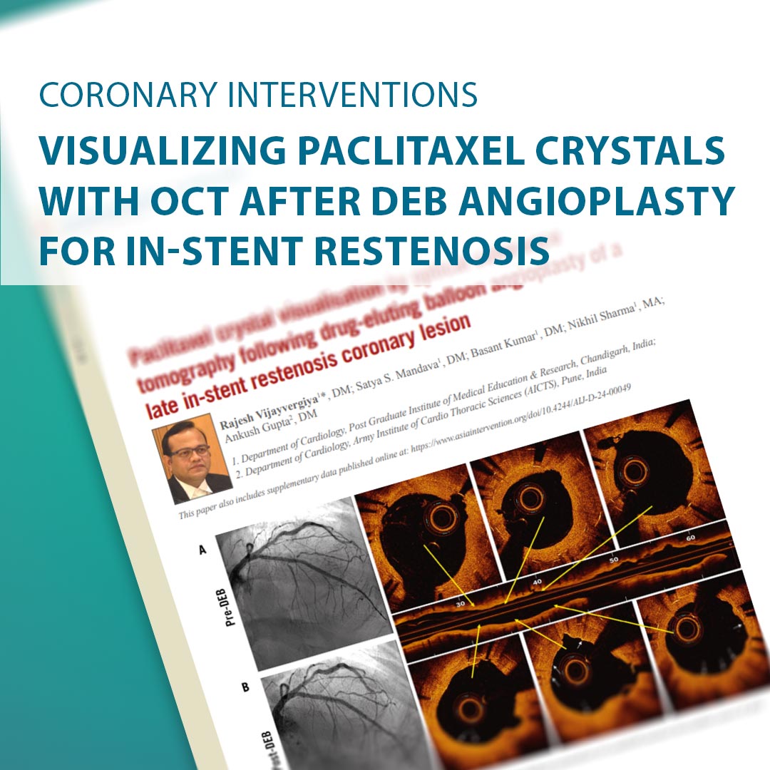 AsiaInterv's tweet image. 61-year-old with recurrent stent blockage treated with #cuttingballoons and #drugelutingtech. #OCT showed success—and paclitaxel crystals. Symptom-free at 4 months! 💉🫀📈 #InterventionalCardiology

Read the full article on AsiaIntervention: 
asiaintervention.org/article/paclit…