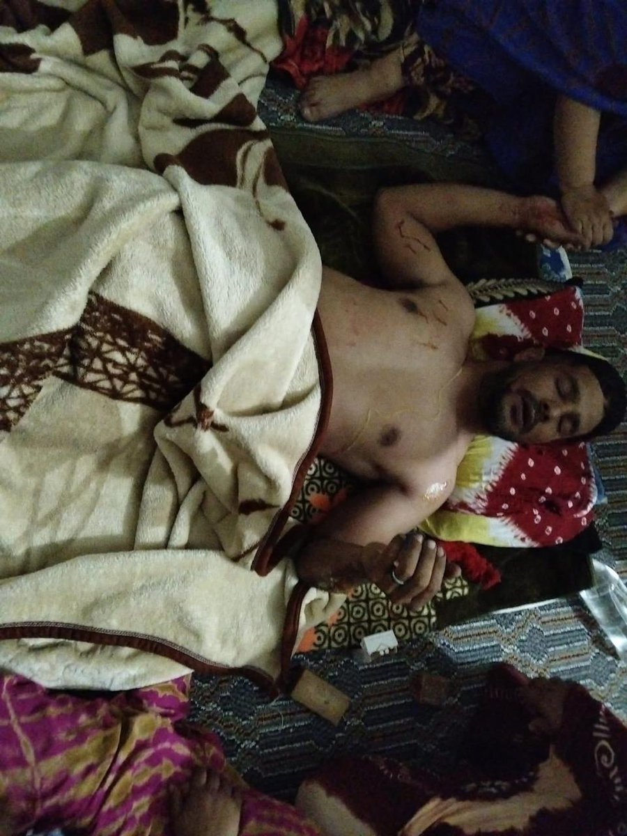 قيادة البوليساريو فقدت السيطرة وأصبحت تمارس القمع ضد الصحراويين داخل المخيمات! الاعتداء الوحشي على ودادي ولد سلمن داخل خيمة عائلته جريمة لا تغتفر. إلى متى يستمر صمت العقلاء؟

#onu #westernsahara #tindouf