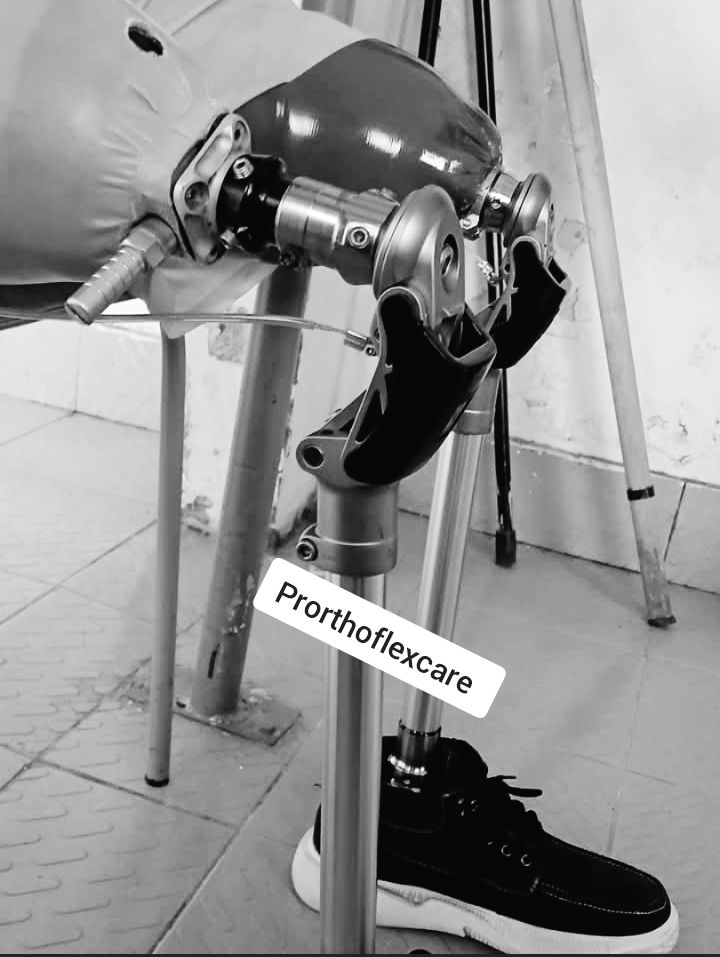 prostheticng's tweet photo. Taking the first steps into a new chapter, each stride is a victory🦿🦿.
Gait training begins, and the journey to strength and independence is underway.
Let's be part of your journey 🦿🦿
#amputeestrong
#prostheticjourney
#gaittraining
#resilienceinmotion
#bilateralamputee https://t.co/HXYNfzk1Mi