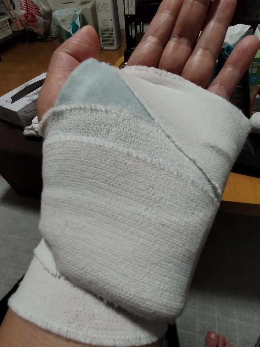 手の甲を骨折しちゃった🥺🥺🥺