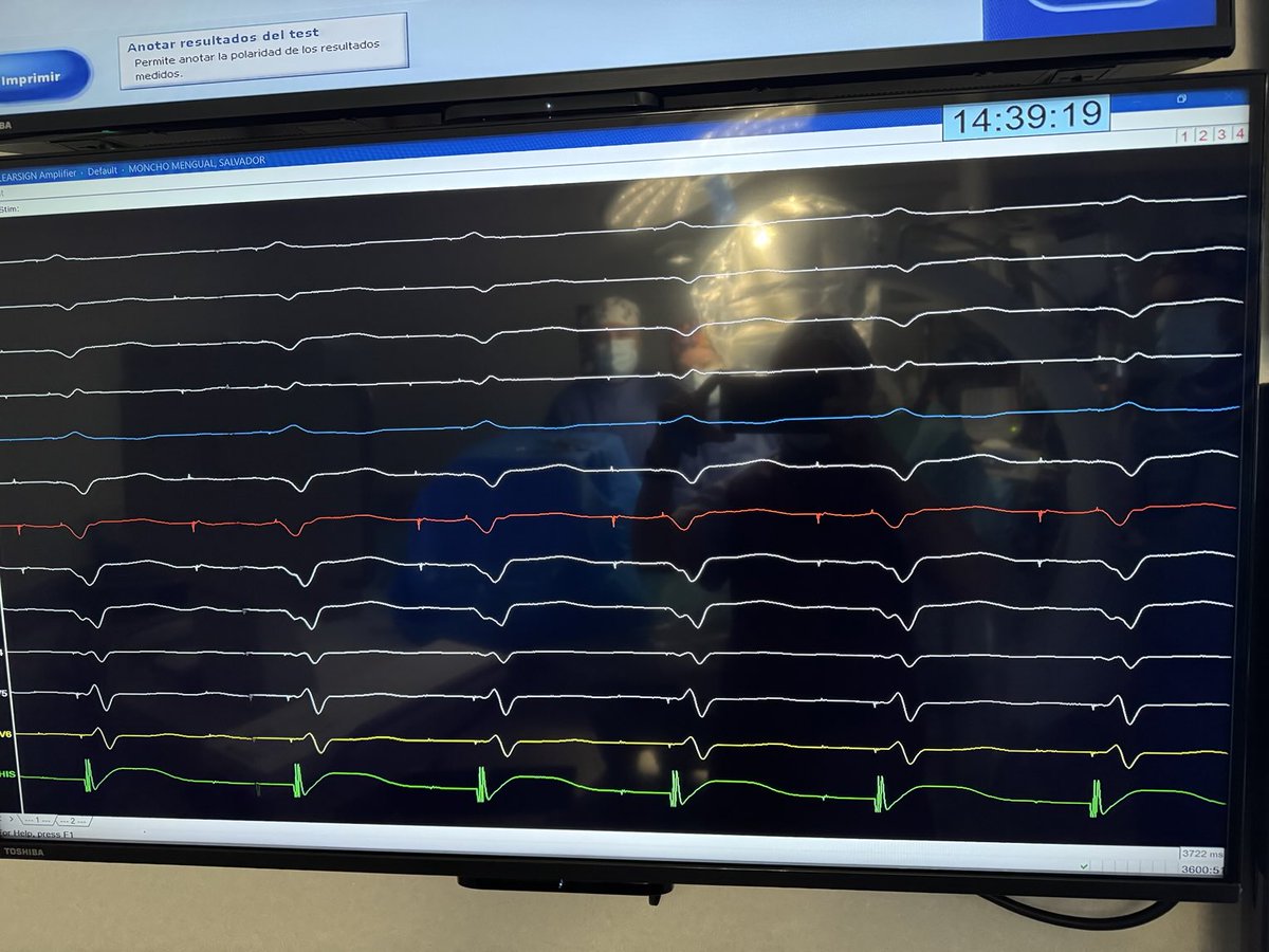 Por fin ya estamos todos bienvenida María #arrytmias ⁦<a href="/UciGandia/">Uci gandía hospital</a>⁩ ⁦<a href="/GVAhgandia/">DS Gandia</a>⁩