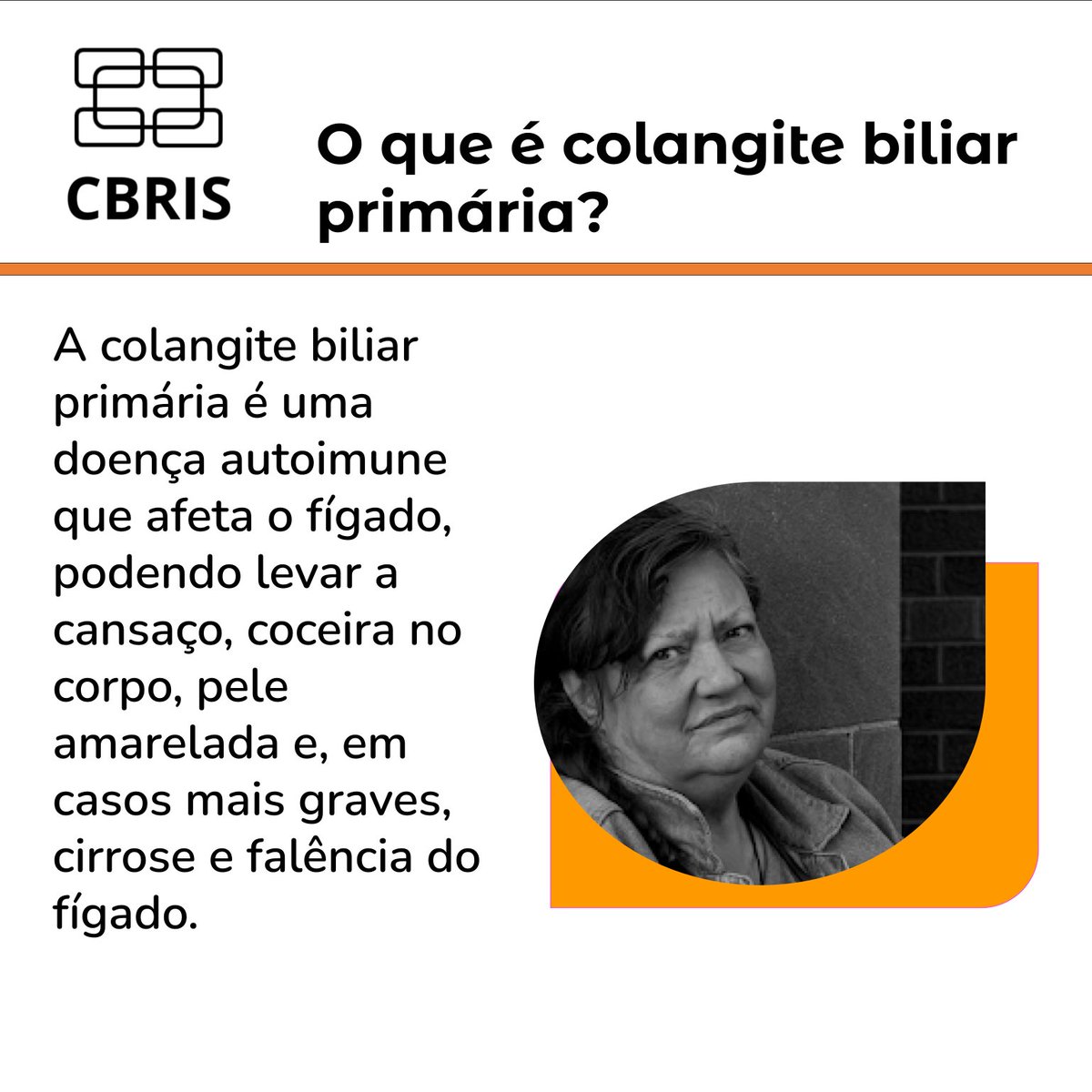 CBRIS_'s tweet photo. Fala, galera! Tudo bem? Para saber mais sobre a Colangite Biliar Primária acesse o link: https://t.co/f18u5tLXFP #usp #fmrp #cbris https://t.co/BjnMFZj3g2
