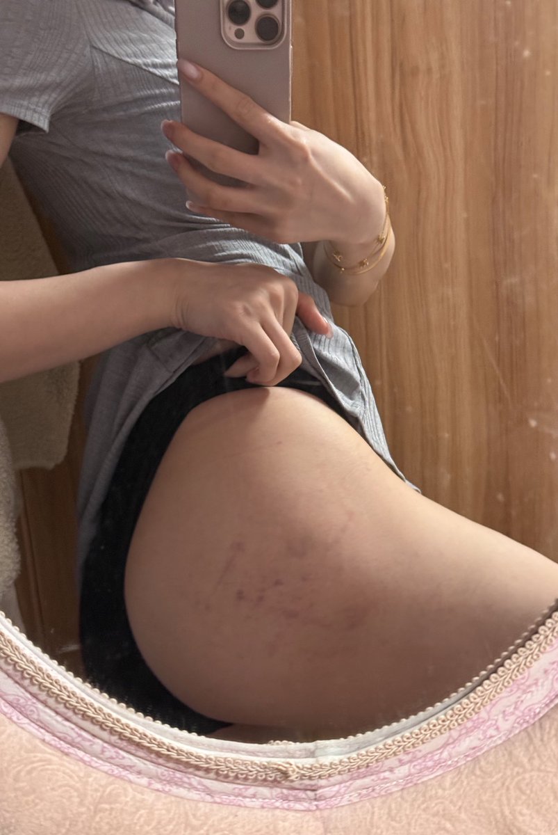 留咗兩日嘅Mark
同影得好好睇嘅曲線
多謝大家🙏🏻