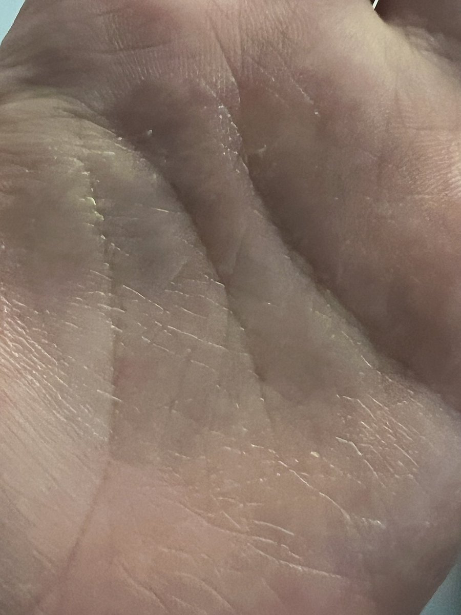 사용 방법은
제품을 짜서 물기 없는 얼굴에 문지르고 롤링 후 물을 묻히며 유화시킨 후 씻어두면 됩니다!!

각질제거도 되는데 저자극이라 민감성도 사용하기 좋다고 해요

또한 탄제린 추출물이 포함되어 있어 좋은 향이 나는 점이 좋았어요