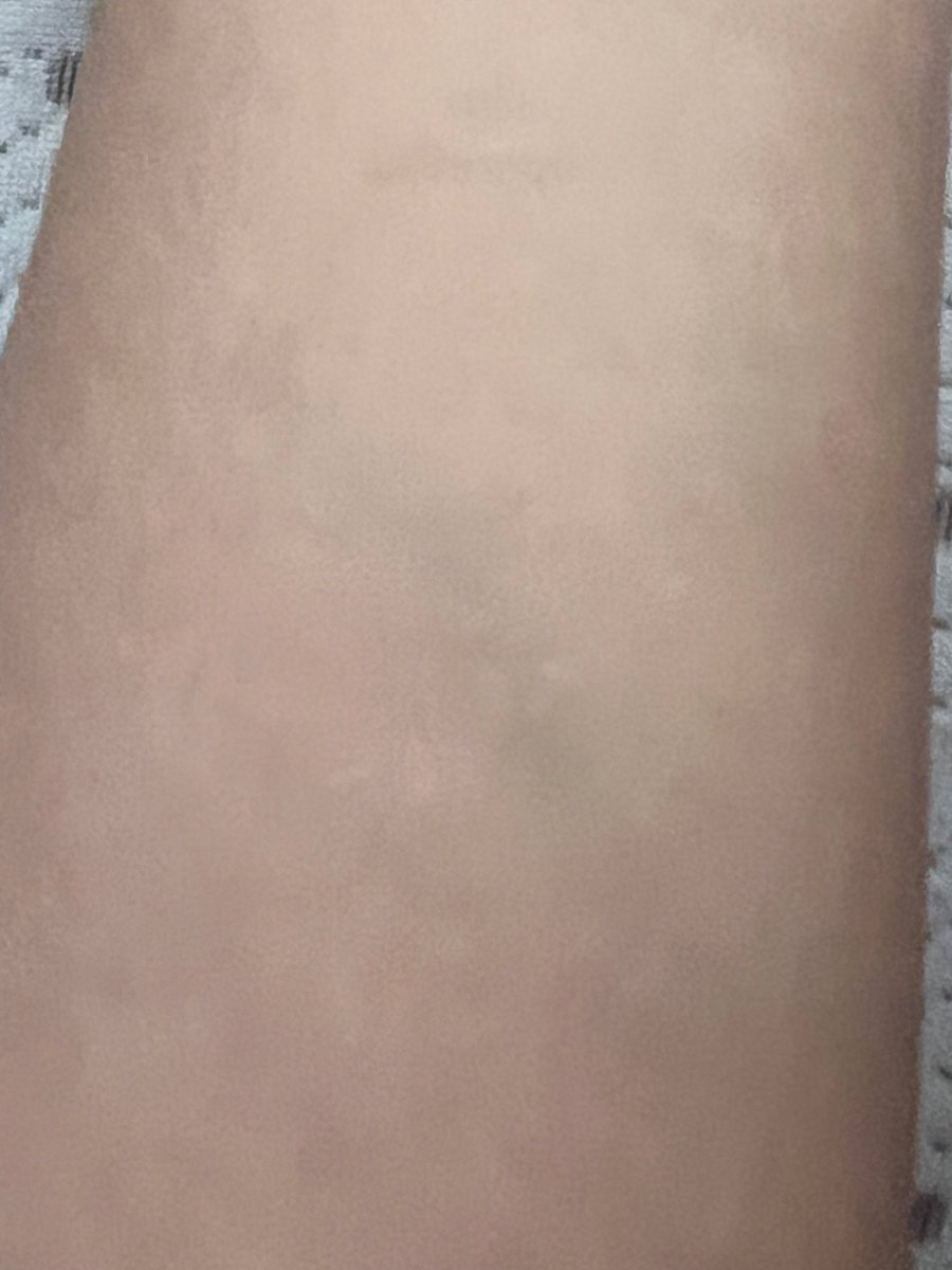 클렌징밤 사용 before와 after 사진입니다!

세정력 진짜 좋은 게 ㅁㅈ 아이라이너 진짜 잘 안 지워지는 제품인데 거의 지워진 거 보이시나요?

N차 세안을 안 해도 클렌징은 깔끔하게 될 거 같다고 생각했어요