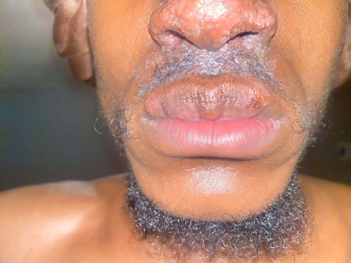 𝕿𝖎𝖒𝖎 𝖓𝖔𝖙 𝕯𝖆𝖐𝖔𝖑𝖔 ☆ tweet media