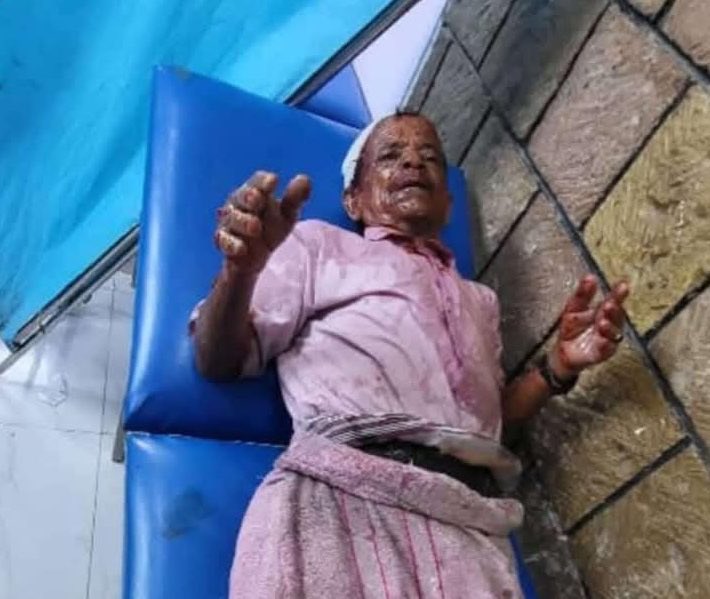 في وطنٍ ينهشه الجوع وتنهشه الميليشيا، يسكب ضابط أمن الزيت المغلي على جسد شيخٍ مسنّ، لا لشيء، إلا لأنه رفض الذل.
في “إبّ” — مدينة الجراح المكتومة — ارتكب المدعو أحمد الطاهري جريمةً ليست فردية، بل صورة مكثفة لوحشية جماعةٍ جعلت من الكرامة جريمة، ومن البسطاء أهدافًا نارية!
رجل مسن