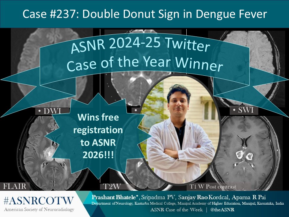 The American Society of Neuroradiology (@theasnr) on Twitter photo Congrats to the #ASNR 2024-2025 X Case of the Year Winner: Case 237: Double Donut Sign in Dengue Fever. The submitting case author wins FREE registration to #ASNR26. Interested in submitting a case? Get the details: ow.ly/sJXc50RH5eo
<a href="/MindAndNeuro/">Prashant Bhatele</a> <a href="/KMC_Socialmedia/">KMC_researchcloud</a> Congrats to the #ASNR 2024-2025 X Case of the Year Winner: Case 237: Double Donut Sign in Dengue Fever. The submitting case author wins FREE registration to #ASNR26. Interested in submitting a case? Get the details: ow.ly/sJXc50RH5eo
<a href="/MindAndNeuro/">Prashant Bhatele</a> <a href="/KMC_Socialmedia/">KMC_researchcloud</a>