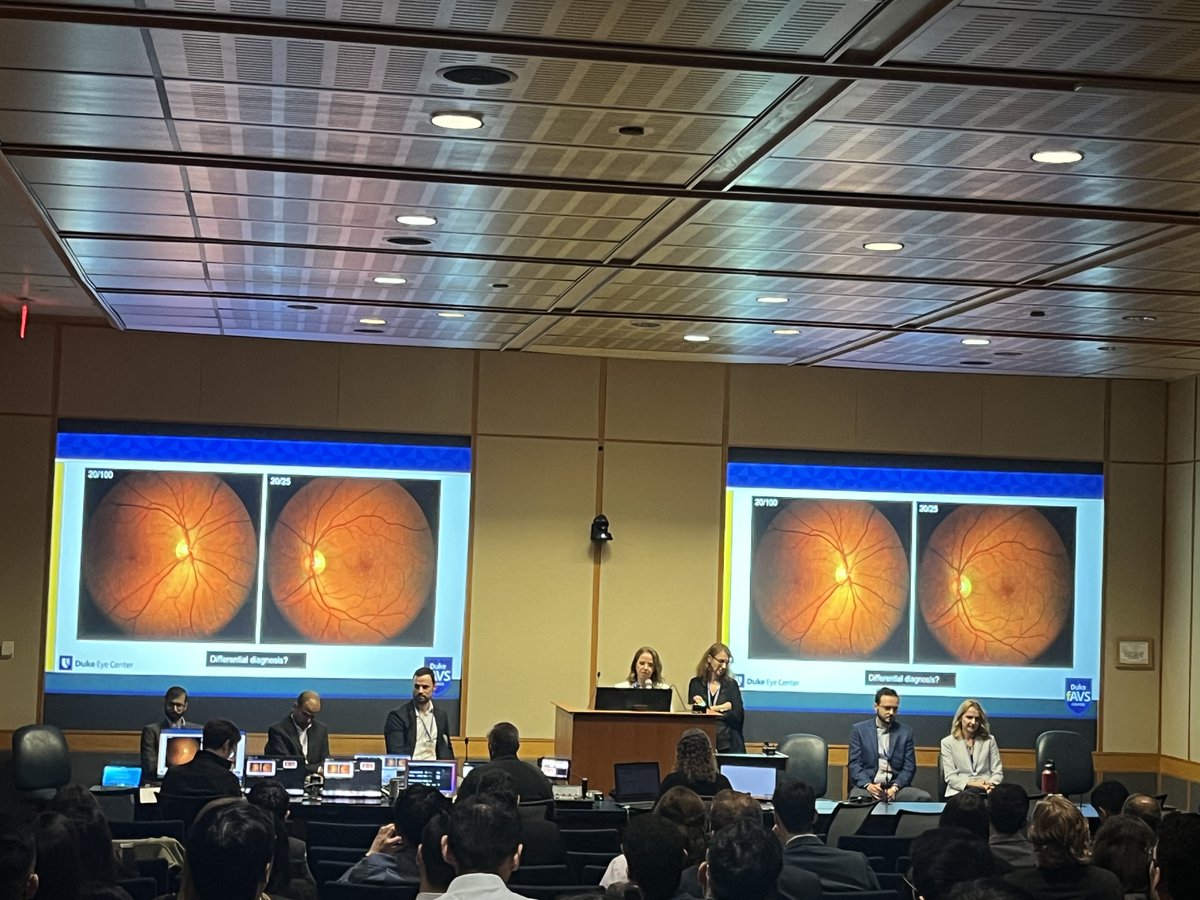 Retina Today (@retinatoday) on Twitter photo Medical retina cases! Panelists discussed new onset wet AMD after cataract surgery, Stargardt disease, and more. <a href="/dukeeyecenter/">Duke Eye Center</a> <a href="/YoungMDConnect/">YoungMD Connect</a> <a href="/DukeMedSchool/">Duke University School of Medicine</a> #retina #fAVS2025 Medical retina cases! Panelists discussed new onset wet AMD after cataract surgery, Stargardt disease, and more. <a href="/dukeeyecenter/">Duke Eye Center</a> <a href="/YoungMDConnect/">YoungMD Connect</a> <a href="/DukeMedSchool/">Duke University School of Medicine</a> #retina #fAVS2025